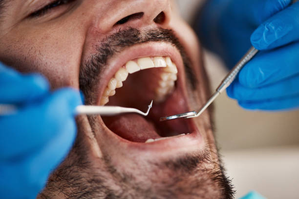 Best Emergency Gum Treatment in Cheyenne, WY